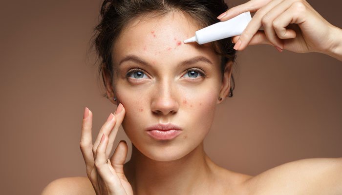 Skincare With Acne The Complete Solution Guide (2026)